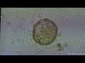 Thumbnail for Tools of the Trade: Microbes Series with Dan Kittredge (Part 2 of 2)