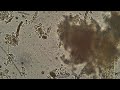 Thumbnail for Compost Tea Brewing: An Introductory Overview